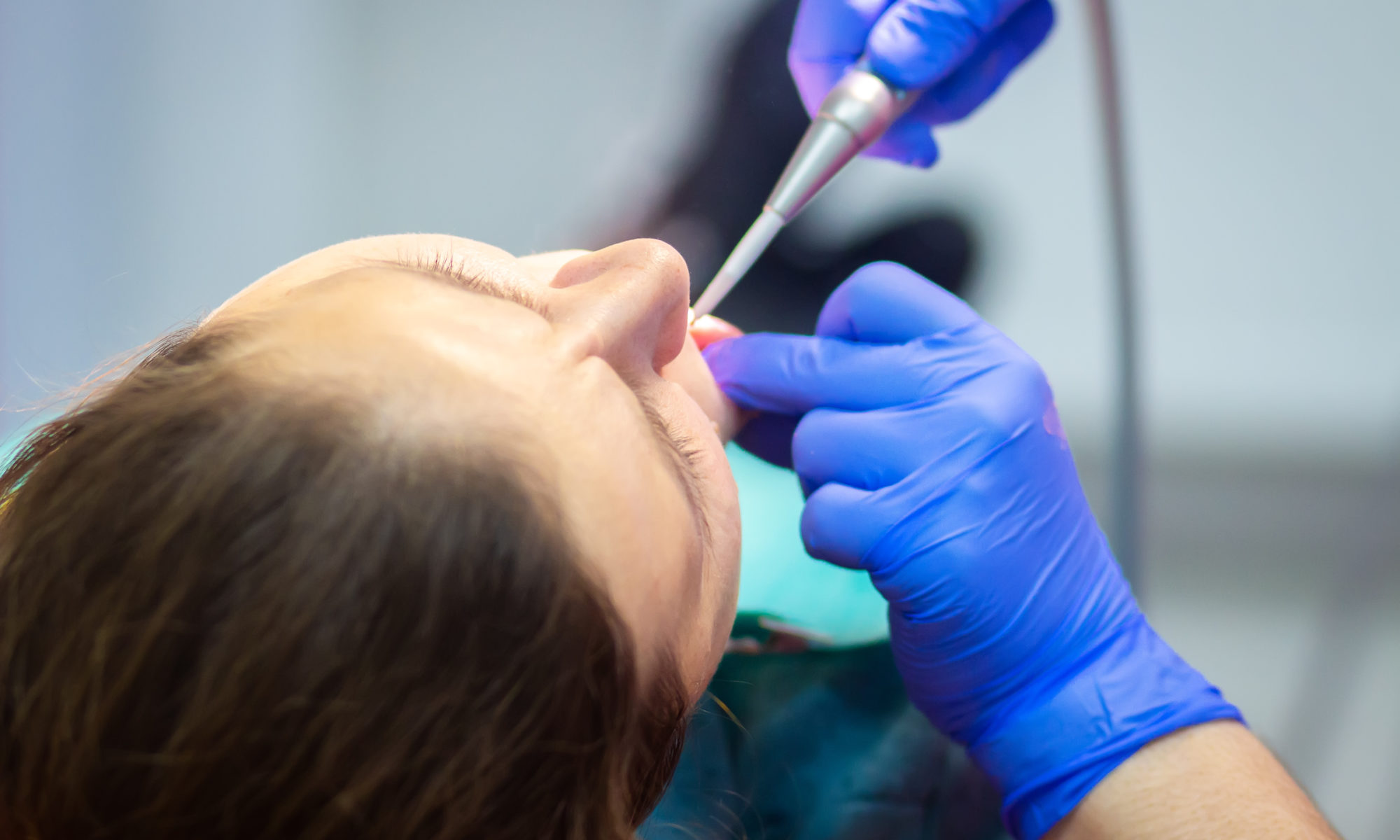 iv sedation dentistry van nuys ca