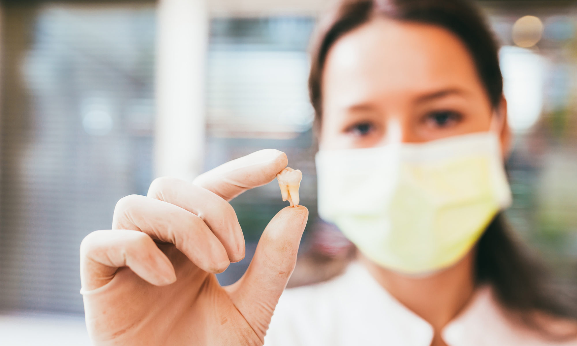 tooth extractions van nuys ca