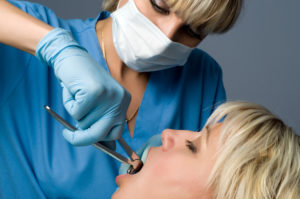 tooth extractions van nuys ca