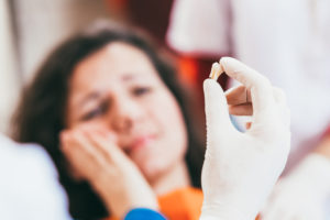 tooth extractions van nuys ca