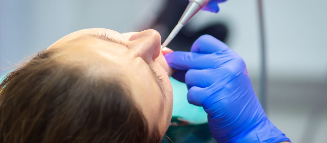 iv sedation dentistry van nuys ca