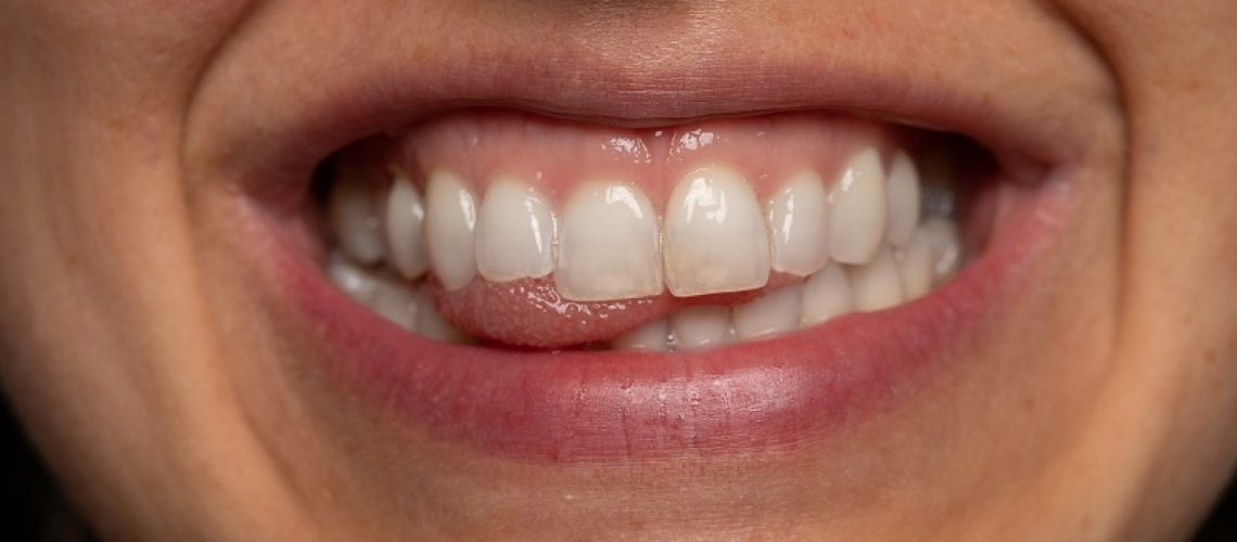 cosmetic dentist van nuys ca