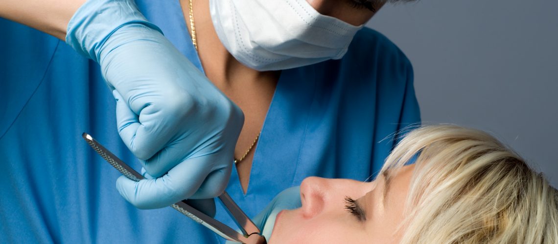 tooth extractions van nuys ca