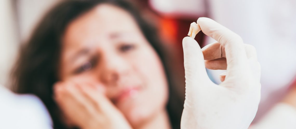 tooth extractions van nuys ca